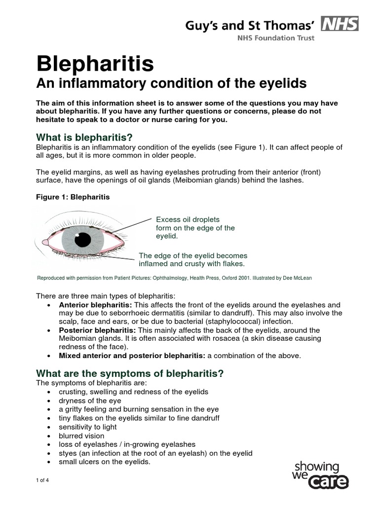 Blepharitis an Inflammatory Condition of the Eyelids Diseases And