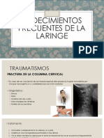 Padecimientos Frecuentes de La Laringe