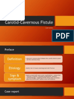 Carotid-Cavernous Fistule: Case Series