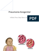 Pneumonia Kongenital