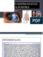 Glaucoma Presentation