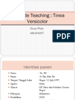 Bed Side Teaching Erna Wati (Stase Kulit)