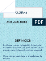 Ulceras Jack