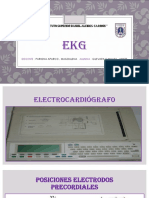 Ekg