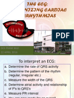 ecg acls 3.ppt