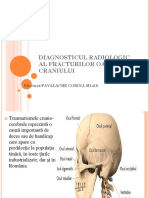 Diagnosticul Radiologic Al Fracturilor Oaselor Craniului