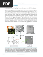 Current Treatment of AL Amyloidosis