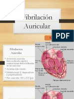 Fibrilación Auricular - Ken Rojas Mamani