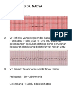 Ekg Tentiran