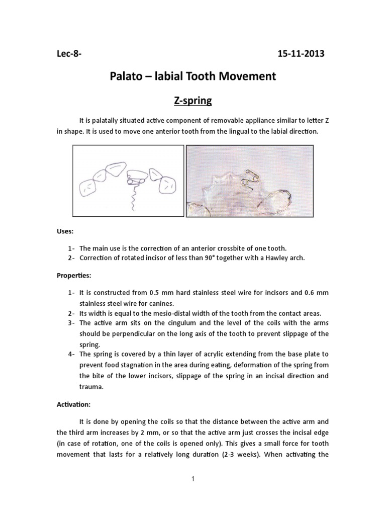 Z Spring and Double Z Spring Overview | PDF | Tooth | Dentistry Branches