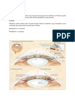 Glaukoma Akut