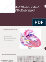 Blok Konduksi Pada Gambaran Ekg