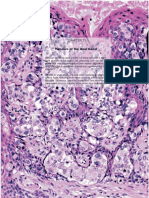 WHO Classification and Staging of Anal Canal Tumours