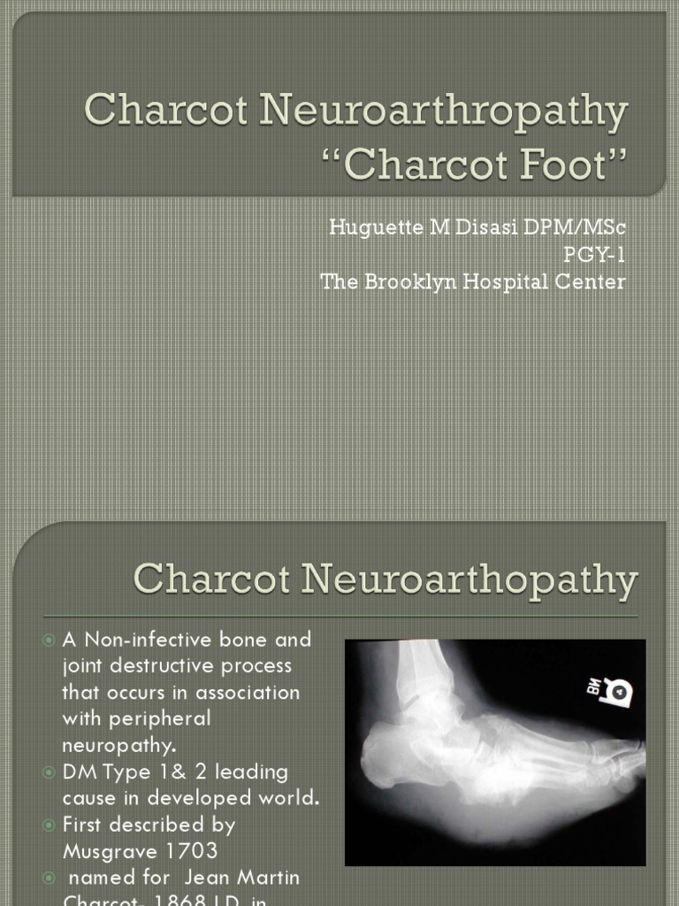 Understanding Charcot Foot in Diabetes | PDF | Peripheral Neuropathy ...