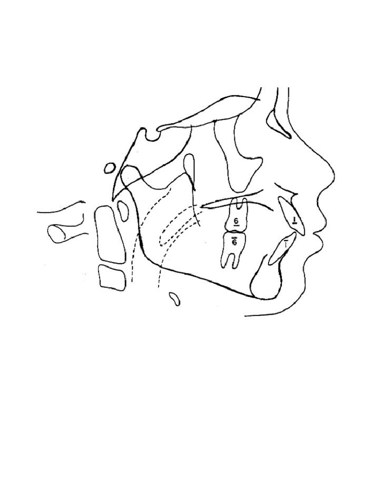GOLDONE PRESTIGE 1 DAY FOR ASTIGMATISM (30) main image 0