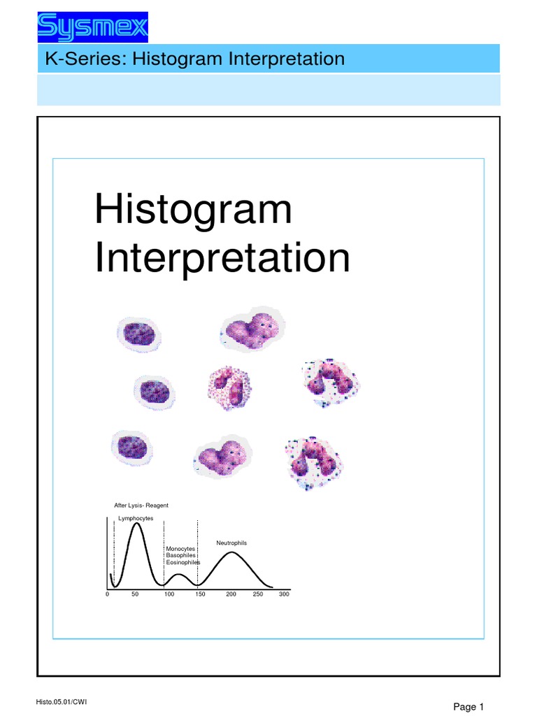 Histogram Interpretation in Hematology | PDF | Anemia | White Blood Cell