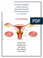 Cervical Polyp 12345