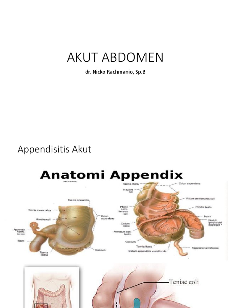 Diagnosis dan Penanganan Apendisitis Akut | PDF
