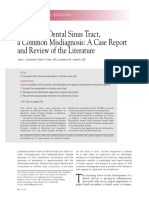 dental sinus tract