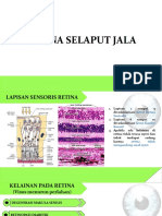 Retina Selaput Jala1