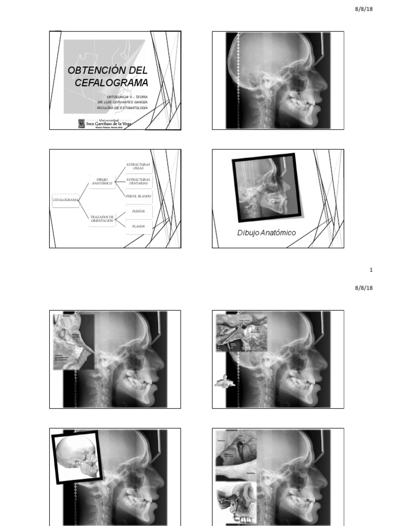 1 - Obtención Del Cefalograma | PDF