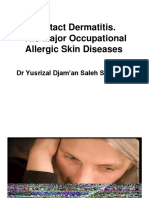 Contact Dermatitis. The Major Occupational Allergic Skin Diseases