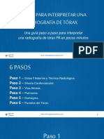 6 Pasos para Interpretar Una Radiografia de Torax