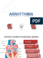 Arrythmia