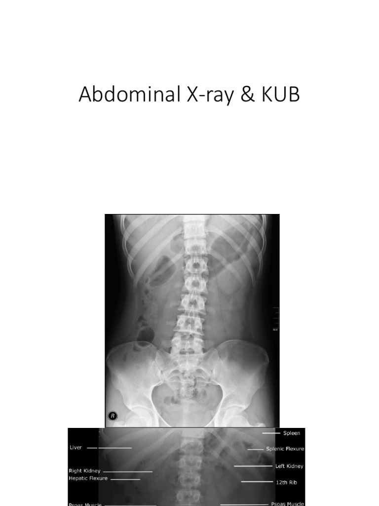 Abdominal X-ray | Organ (Anatomy) | Gastroenterology
