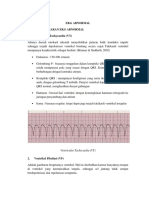 Ekg Abnormal