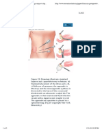 Common Postoperative Findings Unique To Laparoscopic Surgery