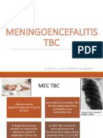Meningoencefalitis TBC