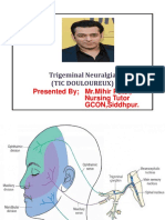 Trigeminal Neuralgia