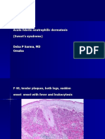  Acute Febrile Neutrophilic Dermatosis., F 40, Leg.