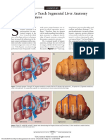 Hand Model For Liver Lobes