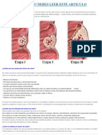 ¿Padeces Colitis_ Debes Leer Este Articulo _ Medicinas Naturales