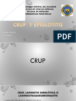 Epiglotitis y Crup