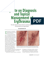 Update on Diagnosis and Topical Management of Erythrasma