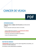 Cáncer de Vejiga