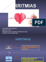 ARRITMIAS