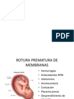 Complicaciones Embarazo