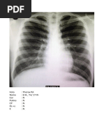 Proyeksi Foto Thorax dan Interpretasinya | PDF