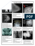 CalcifRadiografías