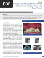 Management of Large Radicular Cyst by Conservative Surgical Approach - A Case Report