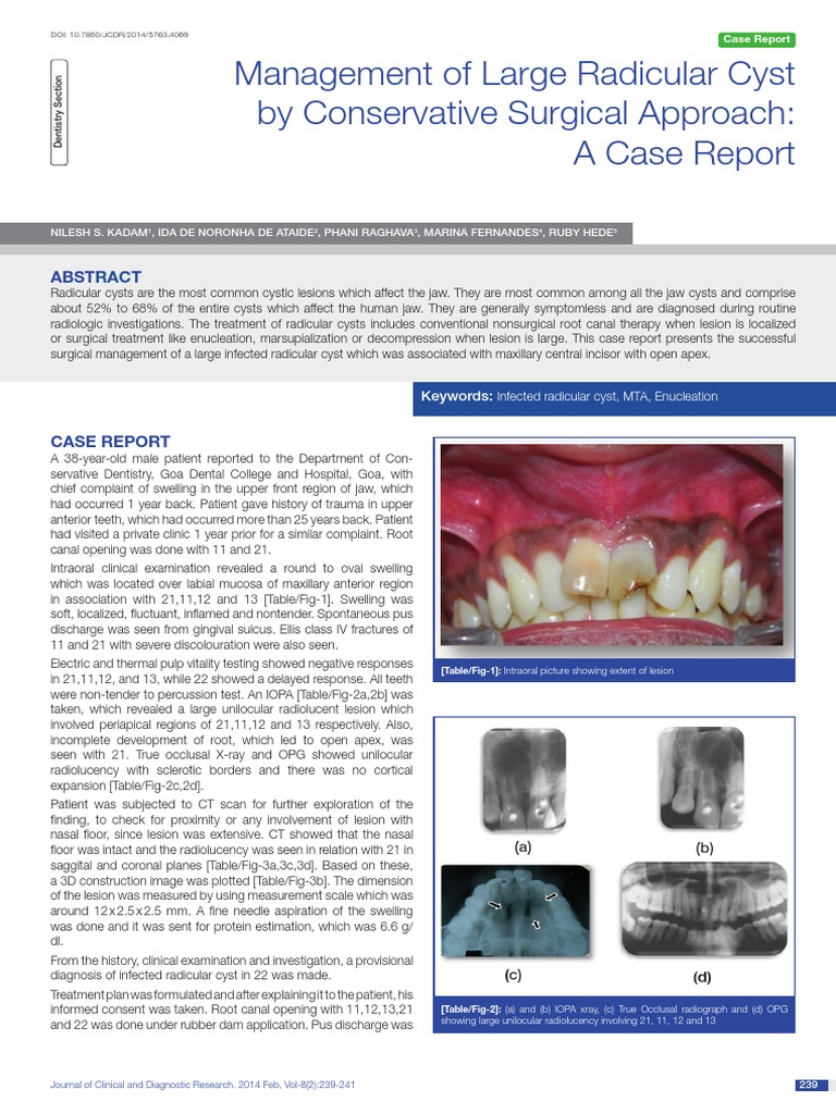Management of Large Radicular Cyst | PDF | Mouth | Dentistry