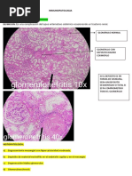 Vitropresión y diascopia en dermatología | PDF | Especialidades Medicas ...