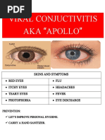 Viral Conjuctivitis AKA "Apollo"