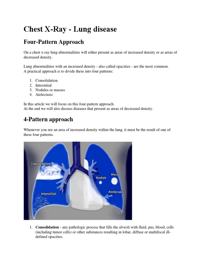 Chest X Ray - 4 | PDF | Pneumonia | Lung
