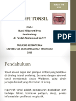 Hipertrofi Tonsil