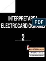 Interpretarea Electrocardiogramei